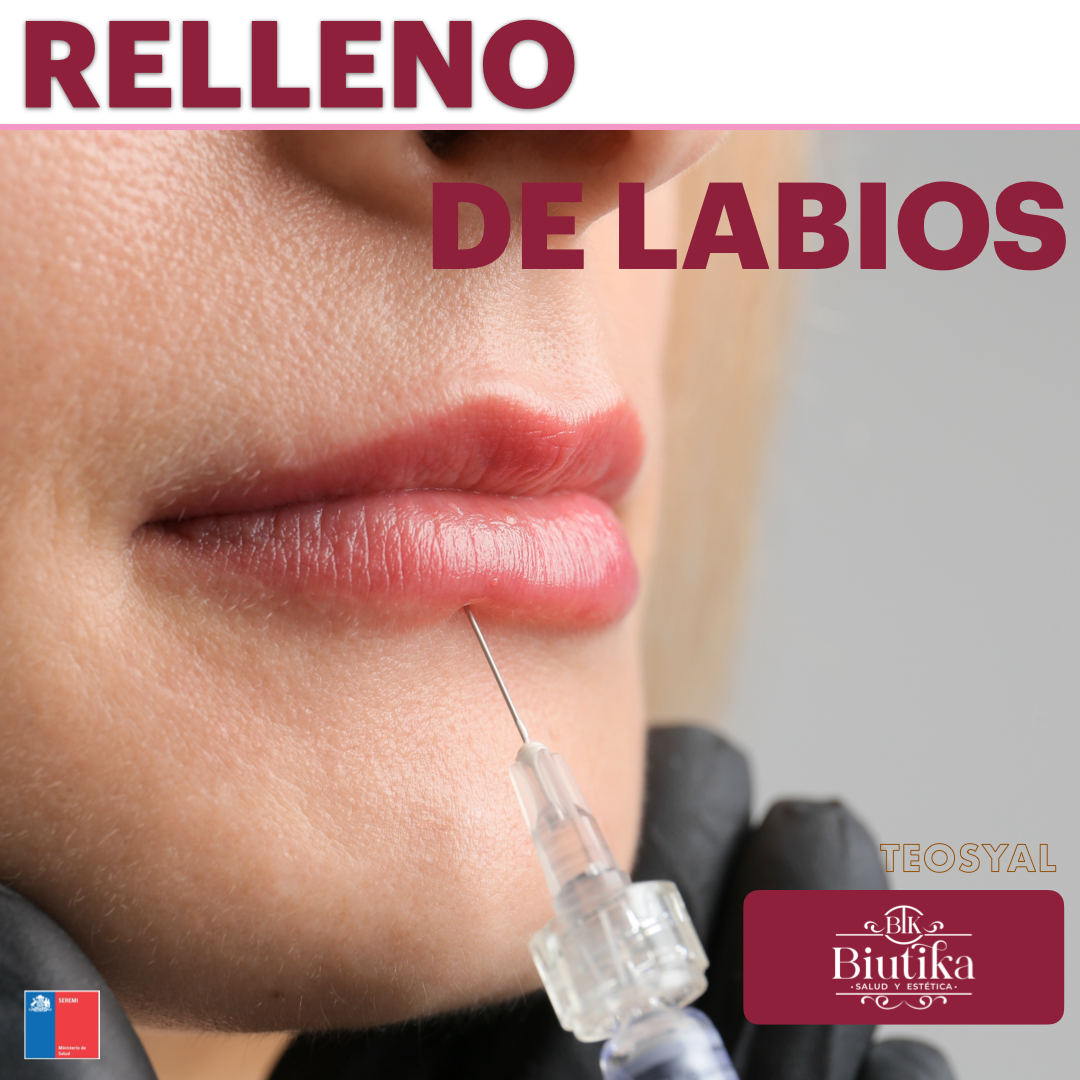 Relleno | aumento de labios